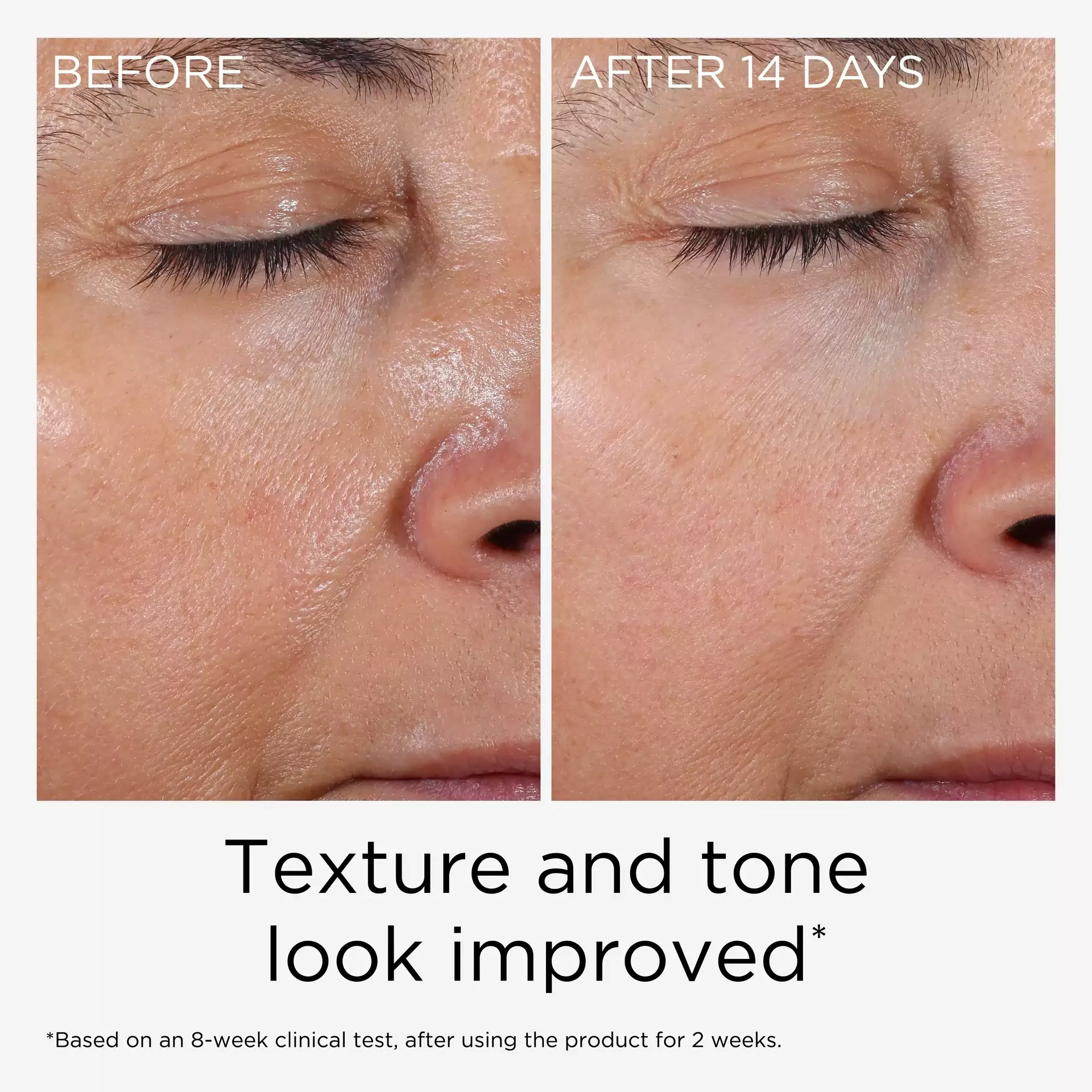 PREVAGE® Anti-Aging Daily Serum 2.0 - Image 7