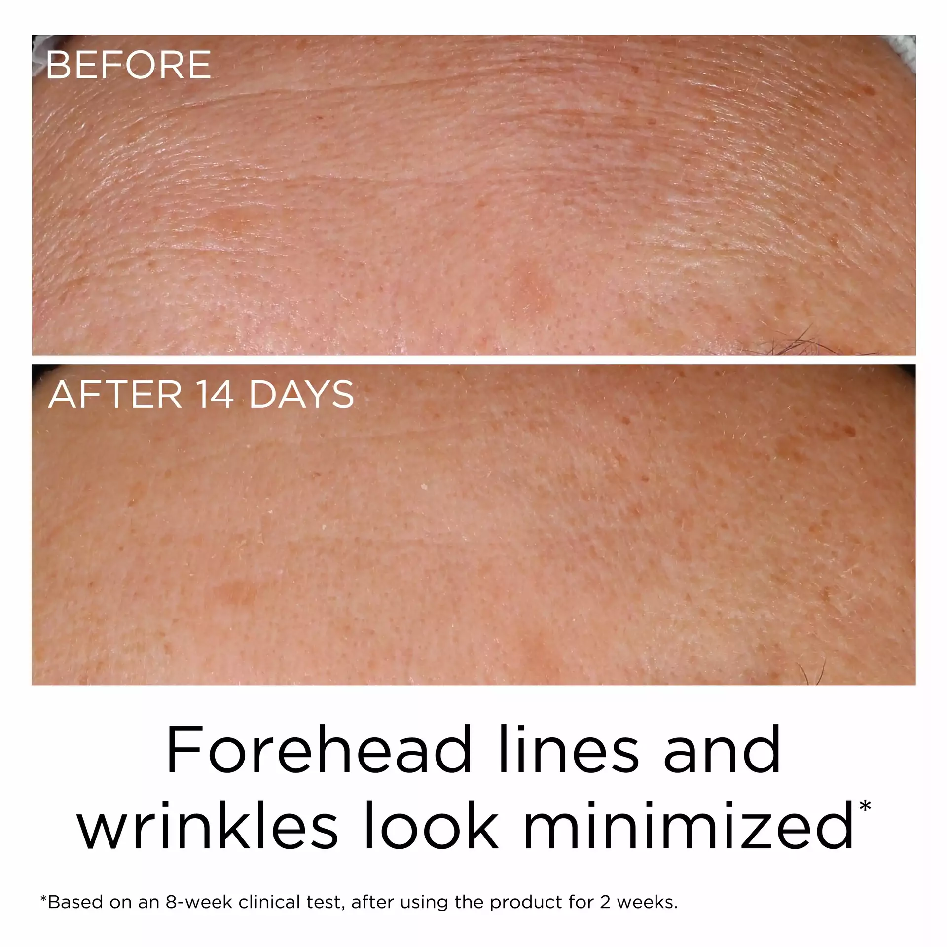 PREVAGE® Anti-Aging Daily Serum 2.0 - Image 8