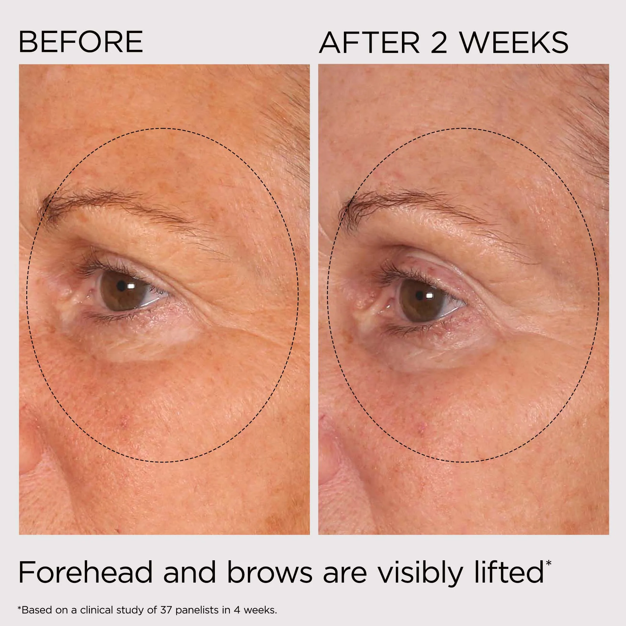 PREVAGE® Multi-Restorative Sculpting Soft Cream - Image 8