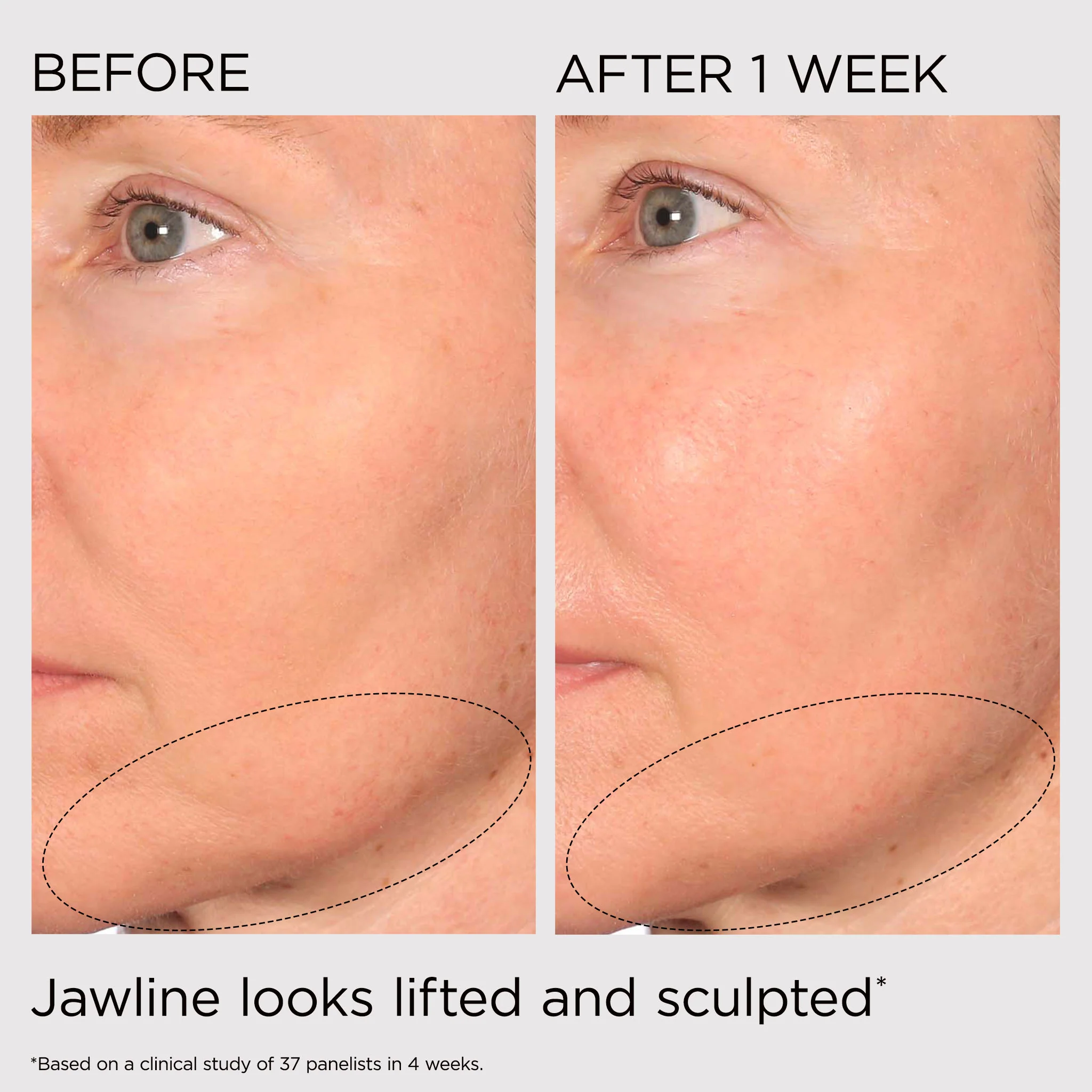 PREVAGE® Multi-Restorative Sculpting Soft Cream - Image 9