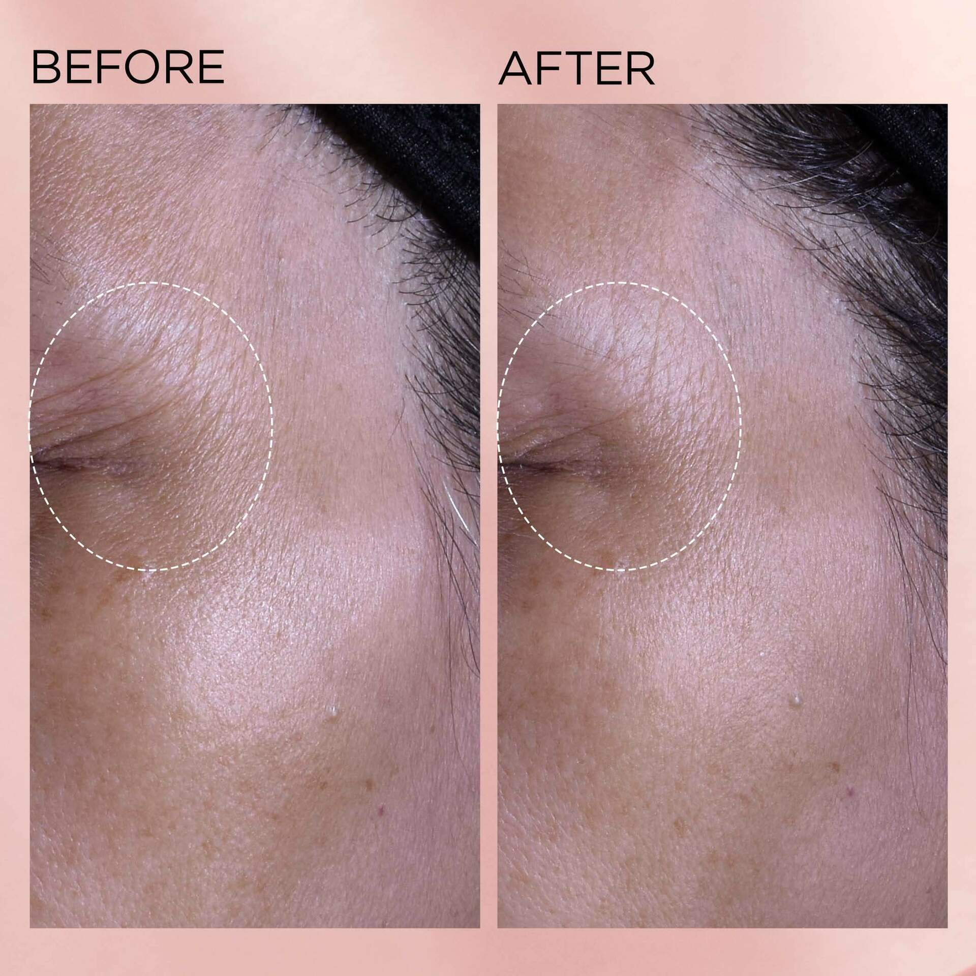 Retinol + HPR Ceramide Rapid Skin-Renewing Water Cream - Image 10