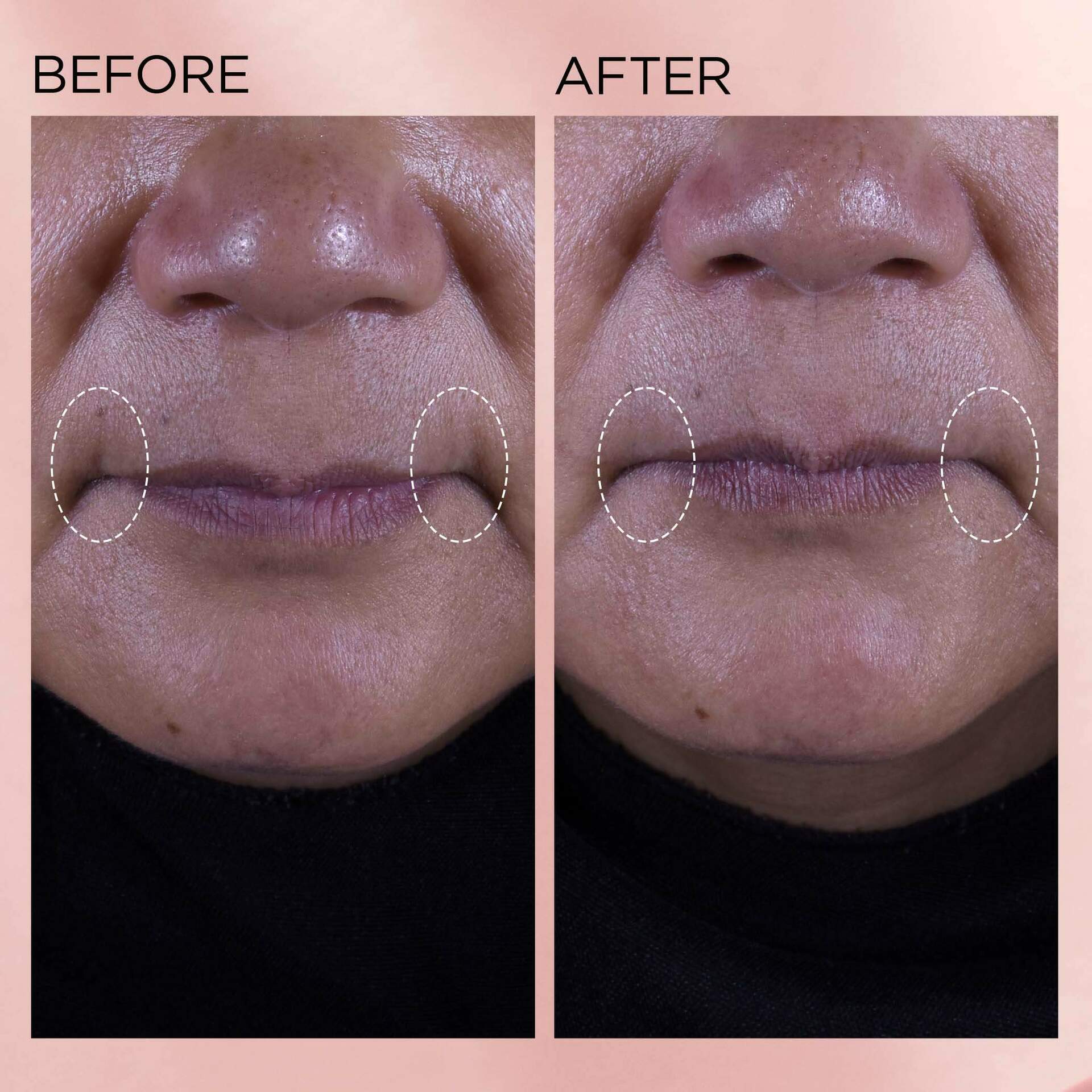 Retinol + HPR Ceramide Rapid Skin-Renewing Water Cream - Image 11