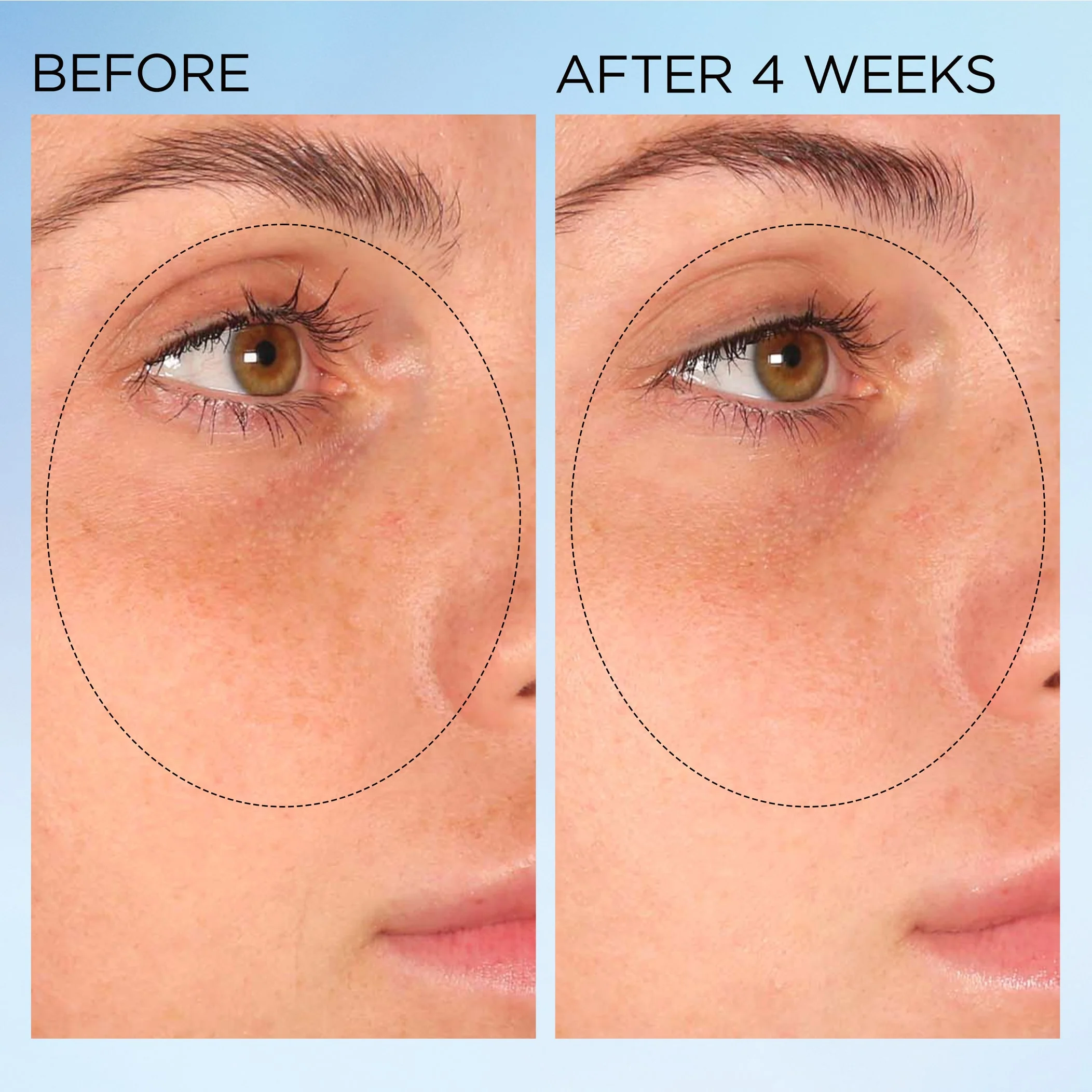 Visible Brightening Clearly Radiant Spot Correcting Capsules Duo - 120 Piece - Image 10