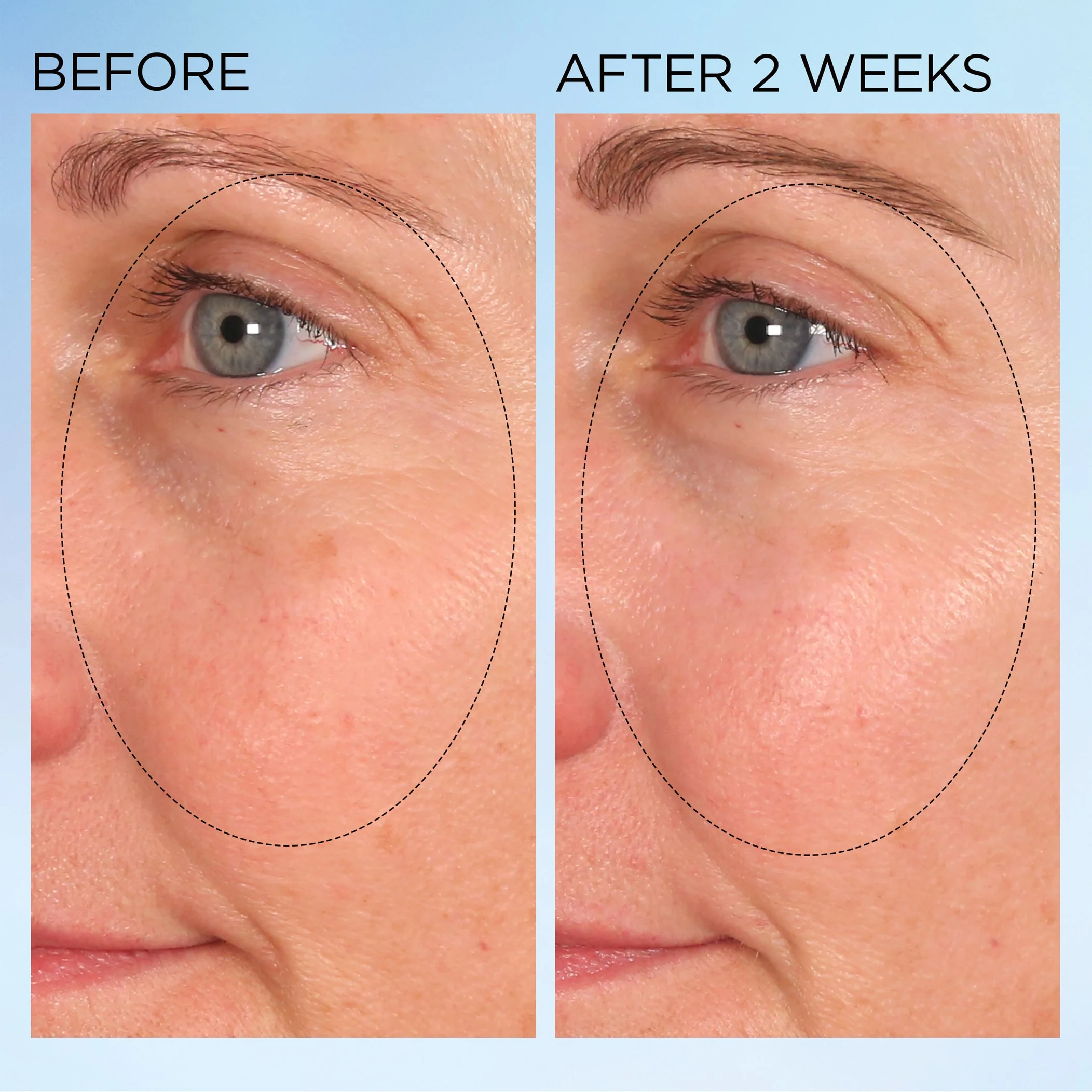 Visible Brightening Clearly Radiant Spot Correcting Capsules Duo - 120 Piece - Image 9